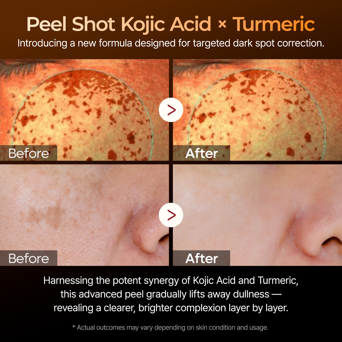 Peel Shot kojic Acid Turmeric Serum