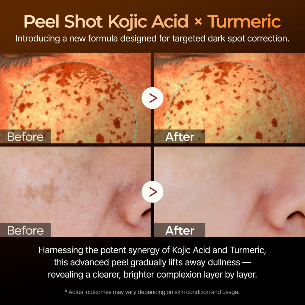 Peel Shot kojic Acid Turmeric Serum