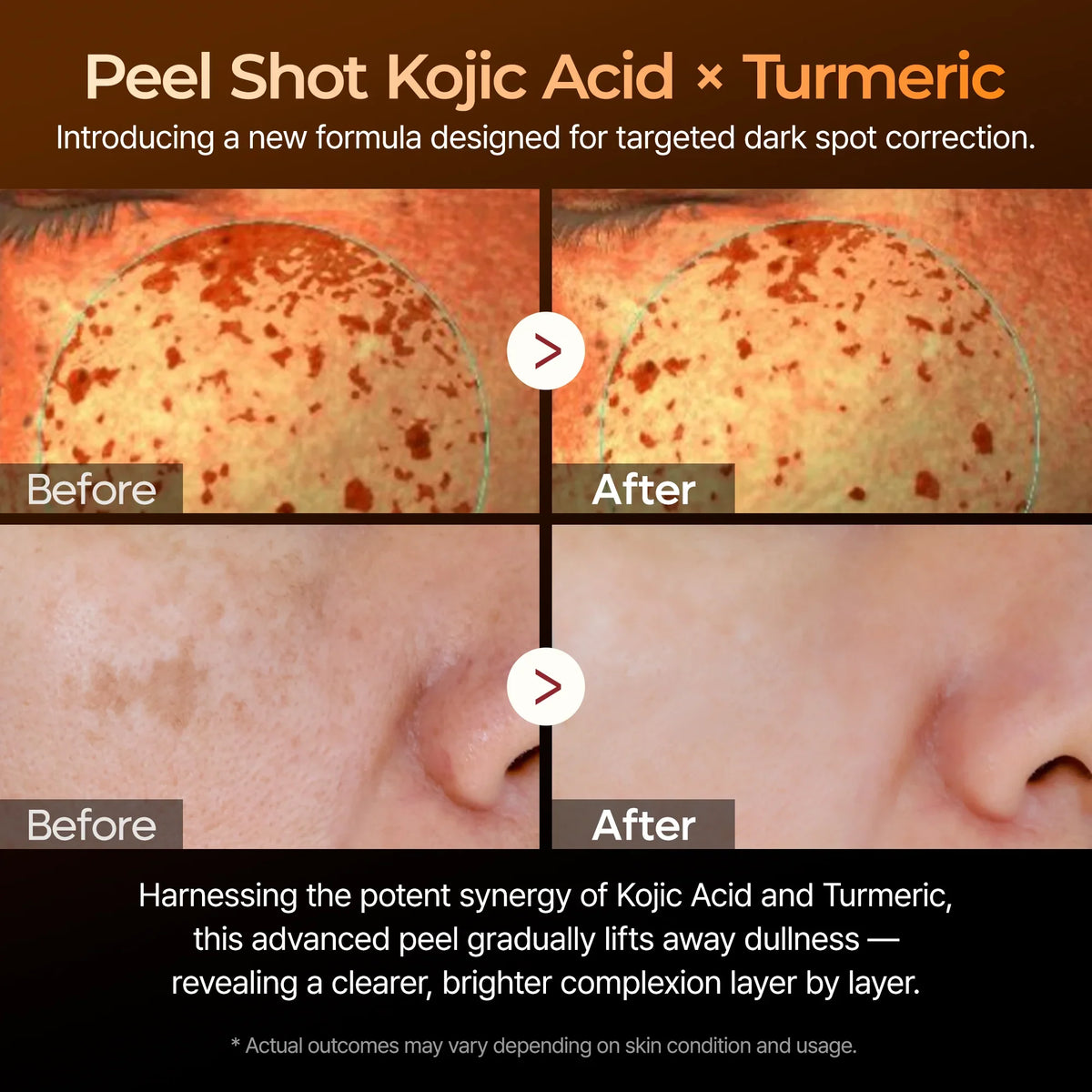 Peel Shot kojic Acid Turmeric Serum