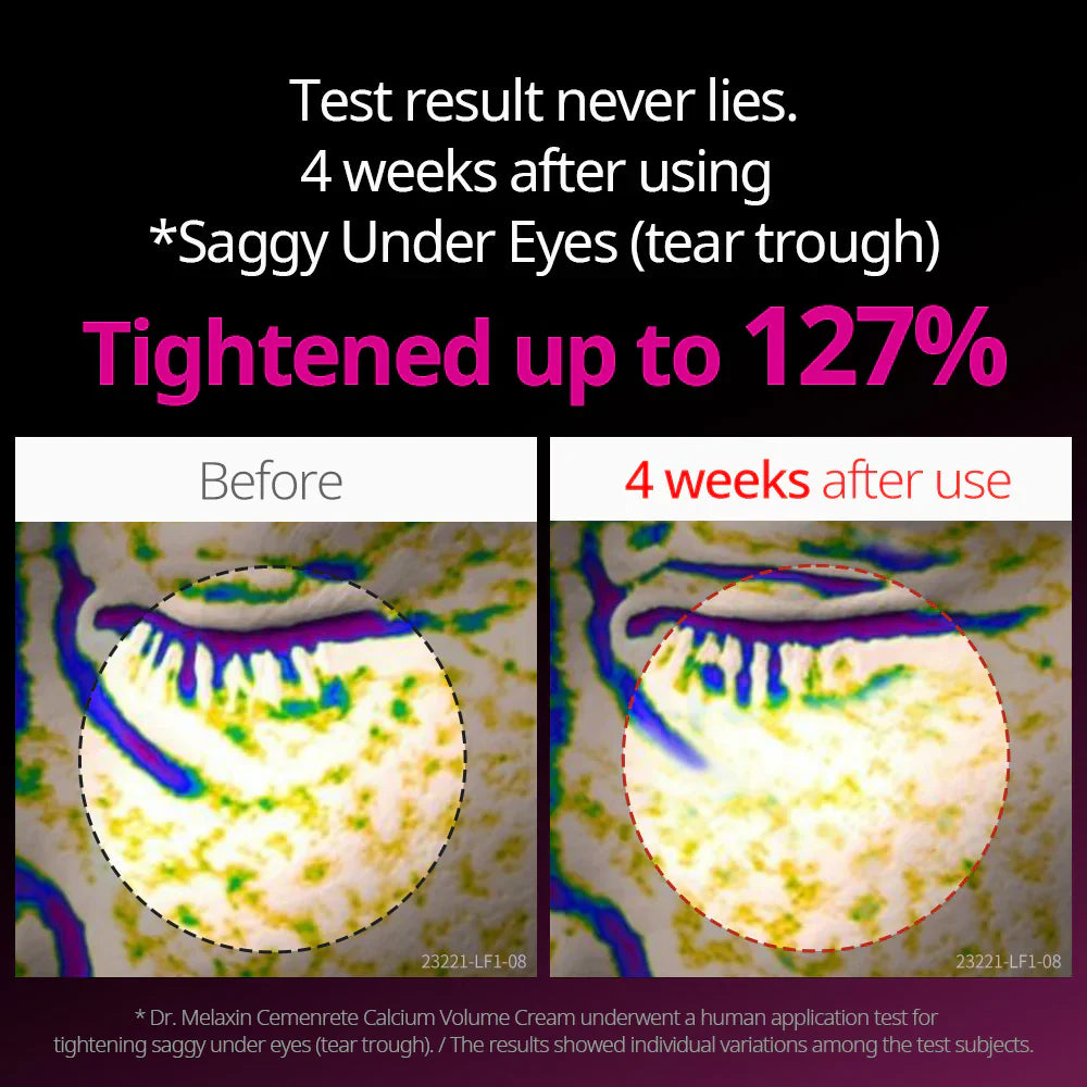 Cemenrete Eye care Line
