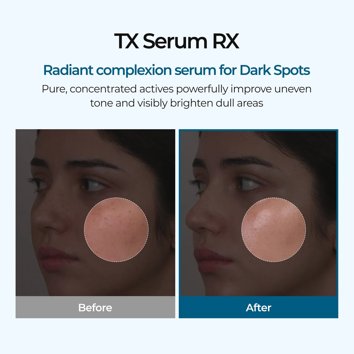 TX Ampoule Rx