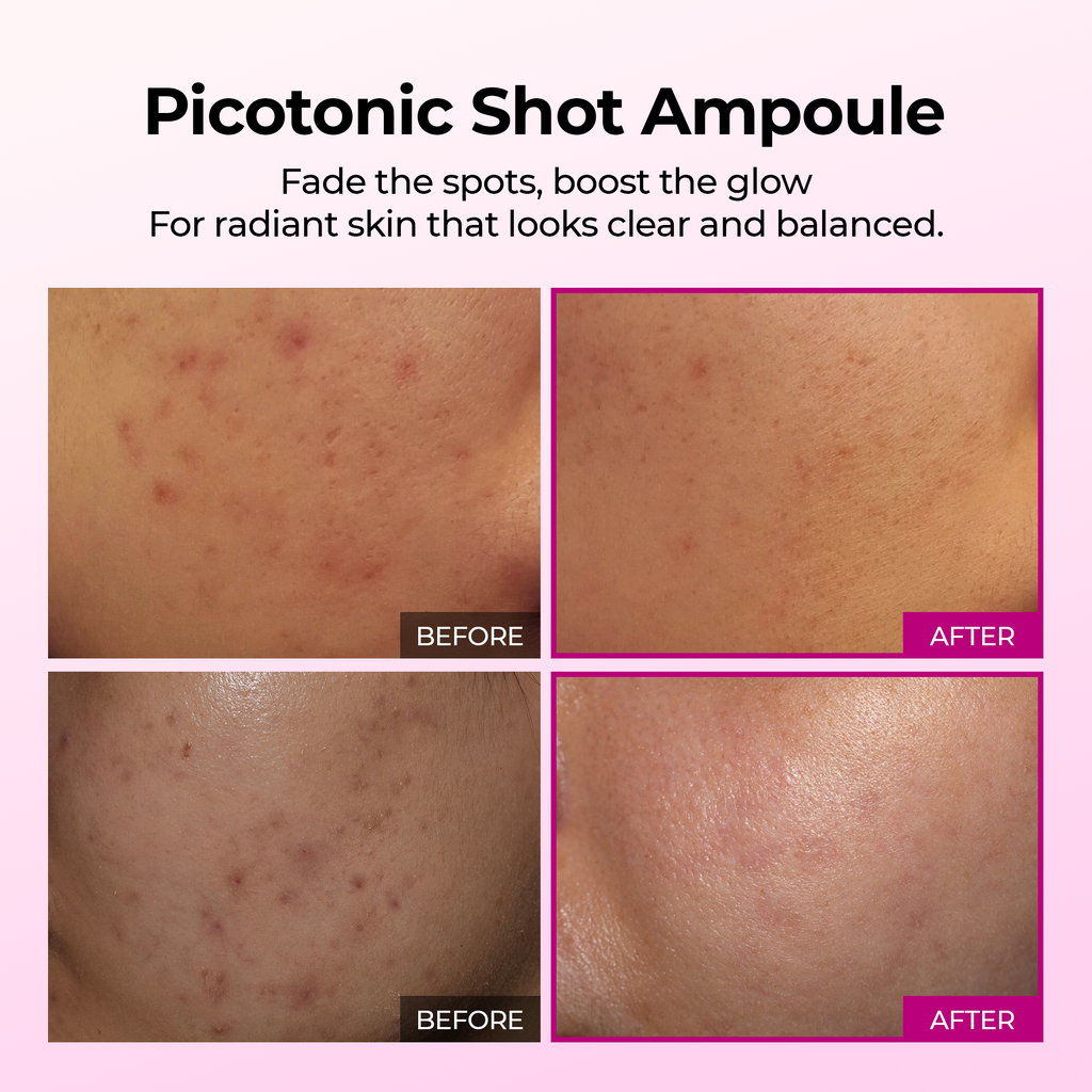 Picotonic Shot Pigmentation Ampoule