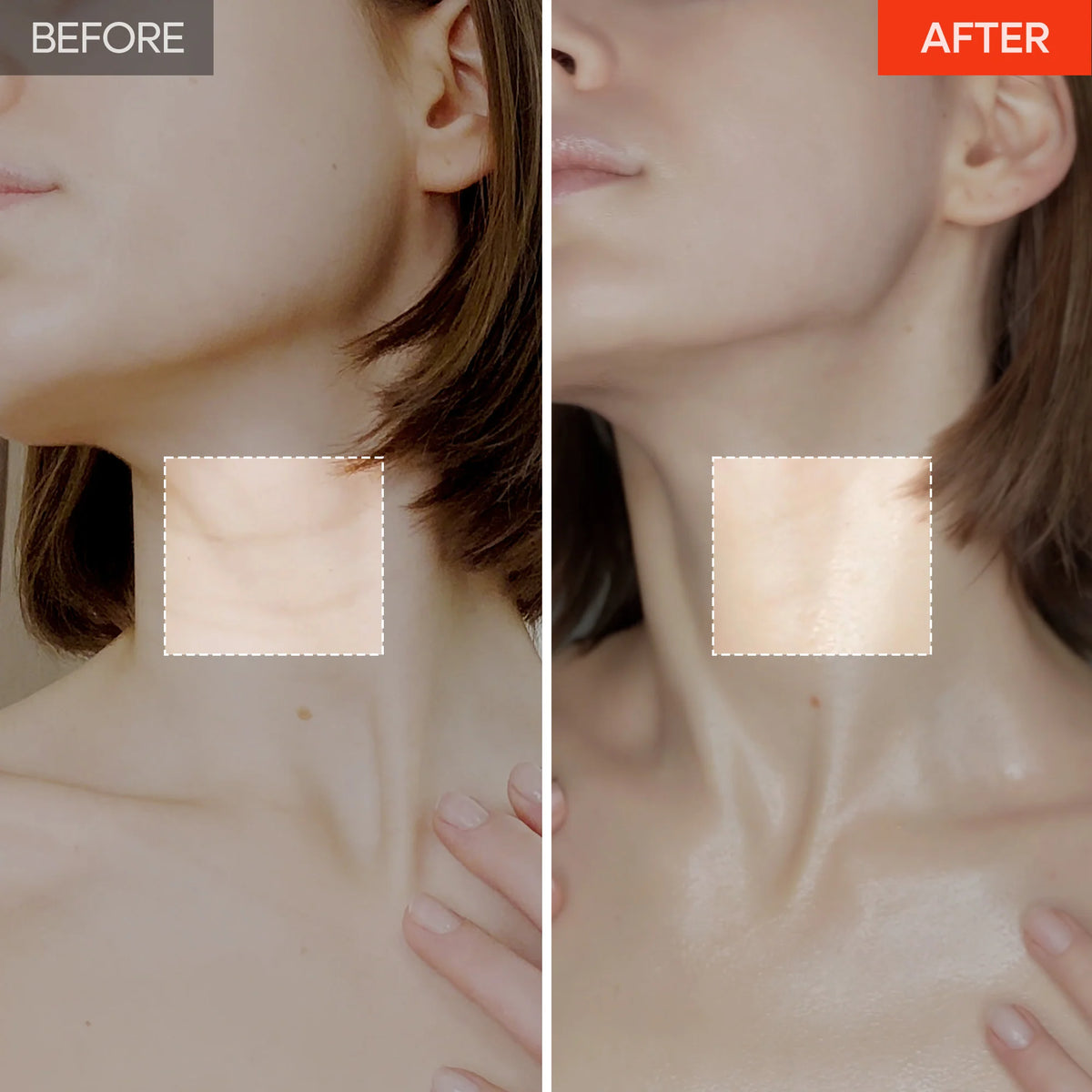 3-Minute Neck Wrinkle Care Trio