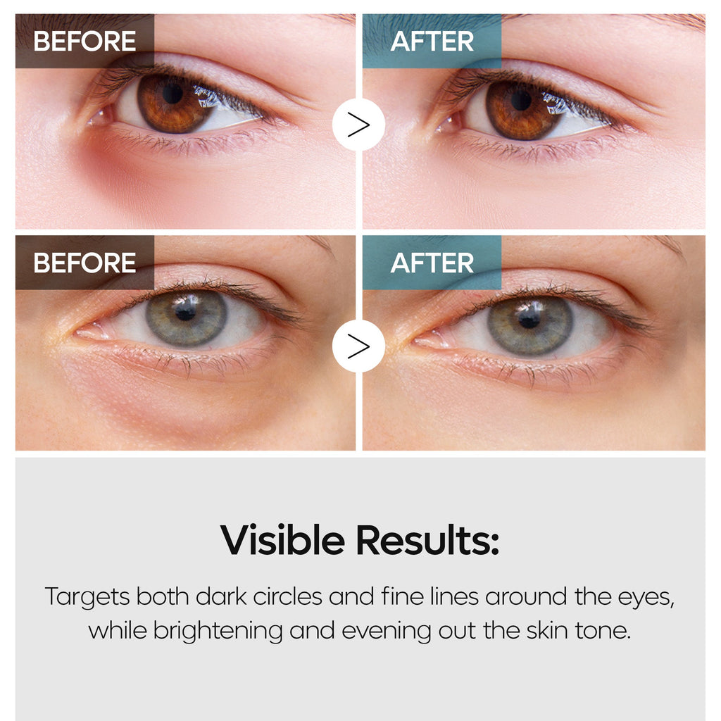 TX Retinalsome Eyecream 40g 1EA
