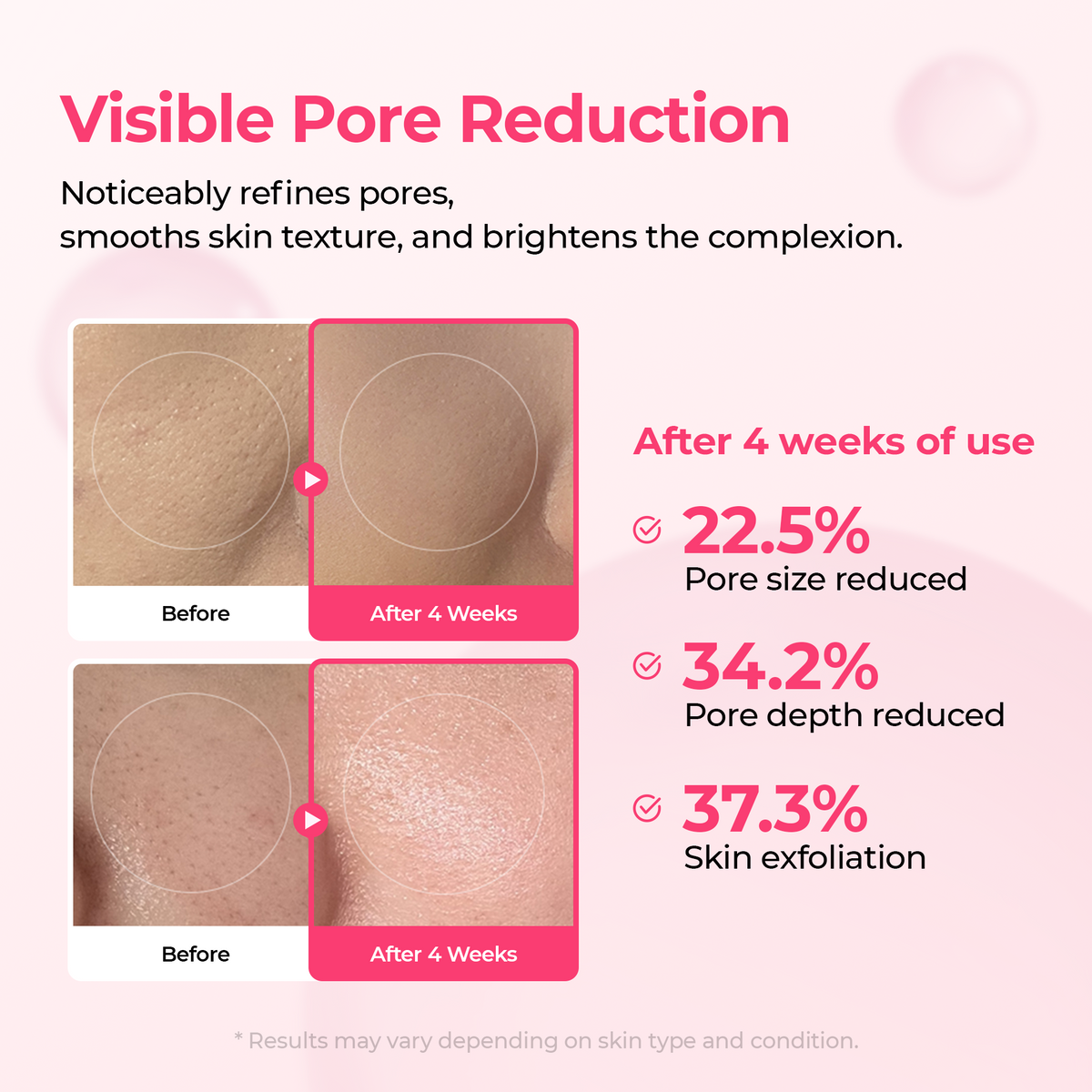 Lumi Pore & Spot Care Duo